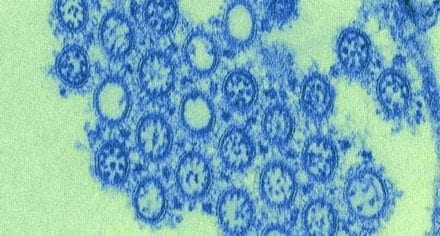 H1N1, a strain of swine flu, under a microscope.