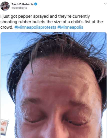 Journalist Zach Roberts tweets photo after being pepper sprayed. 